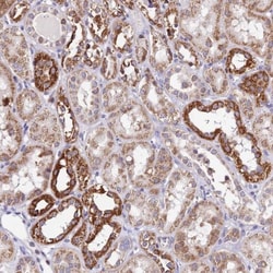 ATP5F1 Antibody, Novus Biologicals 0.1mL; Unlabeled:Antibodies, Polyclonal