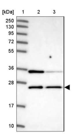 ATP5F1 Antibody, Novus Biologicals 0.1mL; Unlabeled:Antibodies, Polyclonal