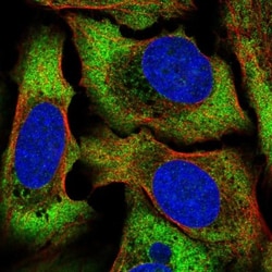 ATP6AP1L Antibody, Novus Biologicals:Antibodies:Primary Antibodies