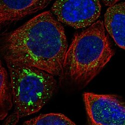 ATP6V0A1 Antibody, Novus Biologicals 0.1mL; Unlabeled:Antibodies, Polyclonal