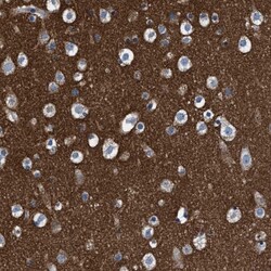 ATP6V0A1 Antibody, Novus Biologicals 0.1mL; Unlabeled:Antibodies, Polyclonal