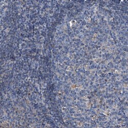 ATP6V0A1 Antibody, Novus Biologicals 0.1mL; Unlabeled:Antibodies, Polyclonal