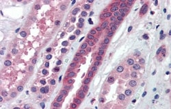 ATP6V0A2 Antibody, Novus Biologicals 0.05mg; Unlabeled:Antibodies, Polyclonal