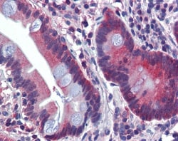 ATP6V0A2 Antibody, Novus Biologicals 0.05mg; Unlabeled:Antibodies, Polyclonal