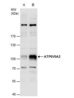 ATP6V0A2 Antibody, Novus Biologicals 0.1mg; Unlabeled:Antibodies, Polyclonal