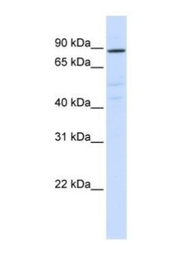 ATP6V0A2 Antibody, Novus Biologicals 0.05mg; Unlabeled:Antibodies, Polyclonal