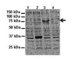 ATP6V0A2 Antibody, Novus Biologicals 0.05mg; Unlabeled:Antibodies, Polyclonal