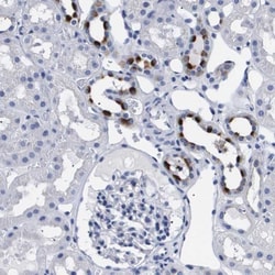 ATP6V0A4 Antibody, Novus Biologicals:Antibodies:Primary Antibodies