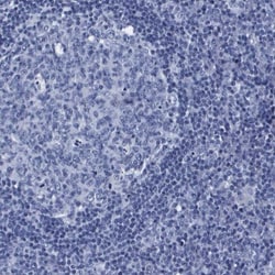 ATP6V0A4 Antibody, Novus Biologicals:Antibodies:Primary Antibodies