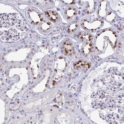 ATP6V0D2 Antibody, Novus Biologicals 0.1mL; Unlabeled:Antibodies, Polyclonal