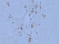 ATP6V0D2 Antibody, Novus Biologicals 0.1mL; Unlabeled:Antibodies, Polyclonal