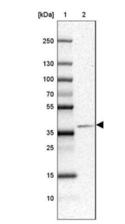 ATP6V0D2 Antibody, Novus Biologicals 0.1mL; Unlabeled:Antibodies, Polyclonal