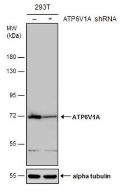 ATP6V1A Antibody, Novus Biologicals 0.1mL; Unlabeled:Antibodies, Polyclonal