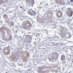 ATP6V1B1 Antibody, Novus Biologicals 25 &mu;L, Unlabeled:Antibodies, Polyclonal