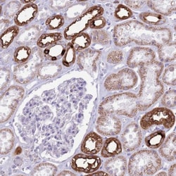 ATP6V1B1 Antibody, Novus Biologicals 25 &mu;L, Unlabeled:Antibodies, Polyclonal
