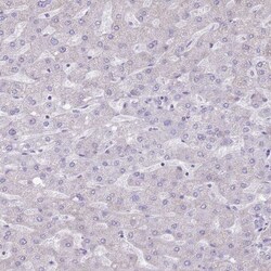 ATP6V1B1 Antibody, Novus Biologicals 25 &mu;L, Unlabeled:Antibodies, Polyclonal