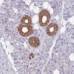 ATP6V1B1 Antibody, Novus Biologicals 25 &mu;L, Unlabeled:Antibodies, Polyclonal