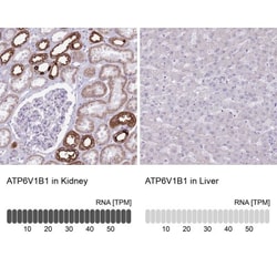 ATP6V1B1 Antibody, Novus Biologicals 25 &mu;L, Unlabeled:Antibodies, Polyclonal