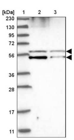 ATP6V1B1 Antibody, Novus Biologicals 25 &mu;L, Unlabeled:Antibodies, Polyclonal