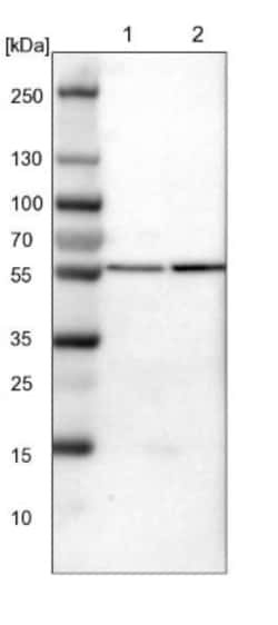 ATP6V1B2 Antibody, Novus Biologicals 0.1 mL | Buy Online | Novus Biologicals | Fisher Scientific