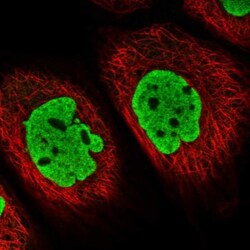 ATP6V1E1 Antibody, Novus Biologicals 0.1mL; Unlabeled:Antibodies, Polyclonal