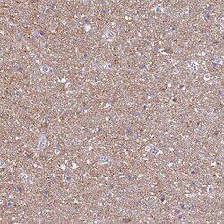 ATP6V1E1 Antibody, Novus Biologicals 0.1mL; Unlabeled:Antibodies, Polyclonal