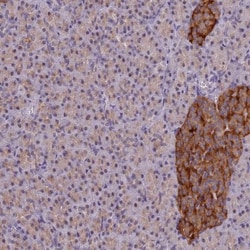 ATP6V1E1 Antibody, Novus Biologicals 0.1mL; Unlabeled:Antibodies, Polyclonal