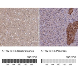 ATP6V1E1 Antibody, Novus Biologicals 0.1mL; Unlabeled:Antibodies, Polyclonal