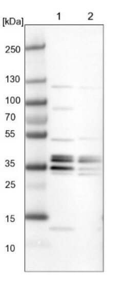 ATP6V1E1 Antibody, Novus Biologicals 0.1mL; Unlabeled:Antibodies, Polyclonal