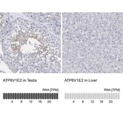 ATP6V1E2 Rabbit anti-Human, Polyclonal, Novus Biologicals:Antibodies:Primary