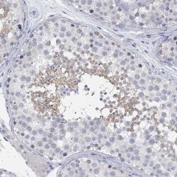 ATP6V1E2 Rabbit anti-Human, Polyclonal, Novus Biologicals:Antibodies:Primary