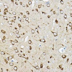 ATP6V1G2 Rabbit anti-Human, Mouse, Rat, Polyclonal, Novus Biologicals 20