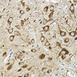 ATP6V1G2 Rabbit anti-Human, Mouse, Rat, Polyclonal, Novus Biologicals 20