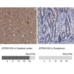 ATP6V1G2 Rabbit anti-Human, Polyclonal, Novus Biologicals 25 &mu;g; Unconjugated:Antibodies,
