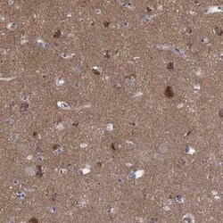 ATP6V1G2 Rabbit anti-Human, Polyclonal, Novus Biologicals 25 &mu;g; Unconjugated:Antibodies,