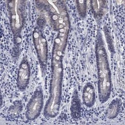 ATP6V1G2 Rabbit anti-Human, Polyclonal, Novus Biologicals 25 &mu;g; Unconjugated:Antibodies,
