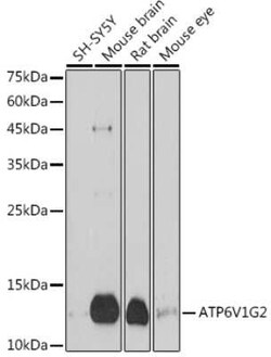 ATP6V1G2 Rabbit anti-Human, Mouse, Rat, Polyclonal, Novus Biologicals 20