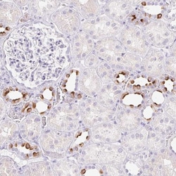 ATP6V1G3 Antibody, Novus Biologicals:Antibodies:Primary Antibodies