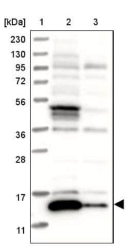 ATP6V1G3 Antibody, Novus Biologicals:Antibodies:Primary Antibodies