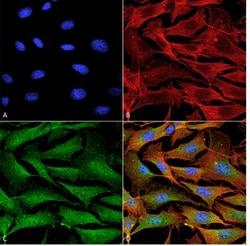 ATP7A Antibody (S60-4), Novus Biologicals 100&mu;g; Unlabeled:Antibodies,