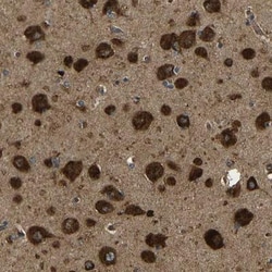ATP7A Antibody, Novus Biologicals 0.1mL; Unlabeled:Antibodies, Polyclonal
