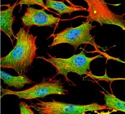 ATP7b Antibody (S62-29), Novus Biologicals:Antibodies:Primary Antibodies