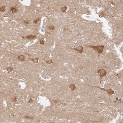 ATP8A1 Antibody, Novus Biologicals 0.1mL; Unlabeled:Antibodies, Polyclonal