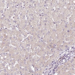 ATP8A1 Antibody, Novus Biologicals 0.1mL; Unlabeled:Antibodies, Polyclonal
