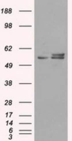 ATPB Antibody (OTI4E5), Novus Biologicals 0.1mL; Unlabeled:Antibodies,