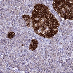 ATPBD4 Antibody, Novus Biologicals 0.1mL; Unlabeled:Antibodies, Polyclonal