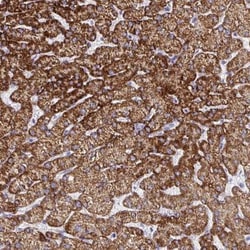 ATPG Antibody, Novus Biologicals 0.1mL; Unlabeled:Antibodies, Polyclonal