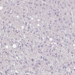 ATPGD1 Antibody, Novus Biologicals:Antibodies:Primary Antibodies