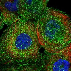 ATPase Na+/K+ beta 3 Antibody, Novus Biologicals 0.1mL; Unlabeled:Antibodies,