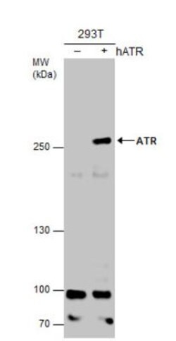 ATR Antibody (2B5), Novus Biologicals 0.1mL; Unlabeled:Antibodies, Monoclonal